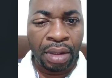 Cameroun : Grève générale des enseignants du supérieur annoncée après la torture du Dr Fridolin NKE